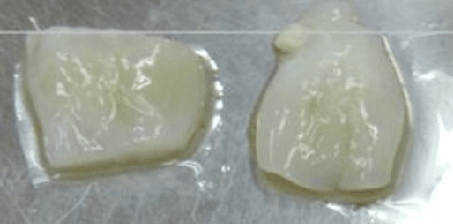 糖化（AG E化）していないコラーゲン画像