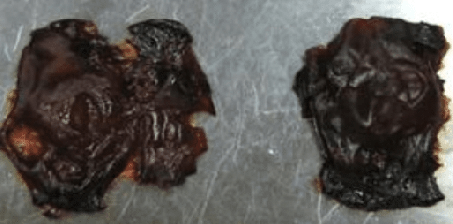 AGE化したコラーゲン（ガチガチ）