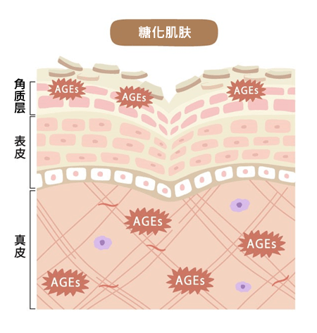 已糖化（AGE化）胶原蛋白